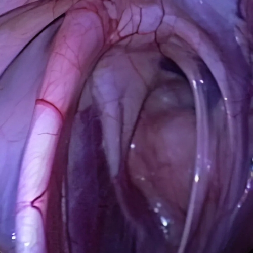 Horse endoscopy