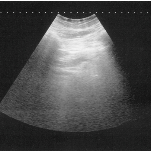 Horse digital ultrasound